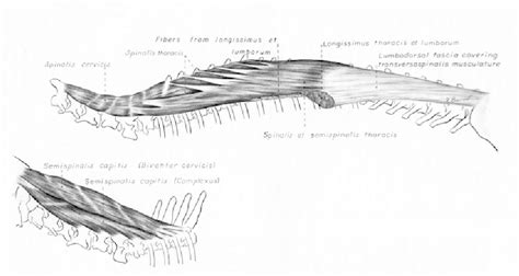 Figure 3 from Evaluation of epaxial muscle structure in dogs with spinal disease | Semantic Scholar