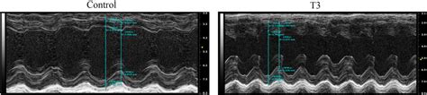 Lv Echocardiographic Representative Images In Control And T Groups