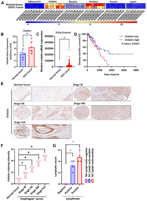 Clinicopathologic Features Of Visfatin Expression In Human Escc Tissue