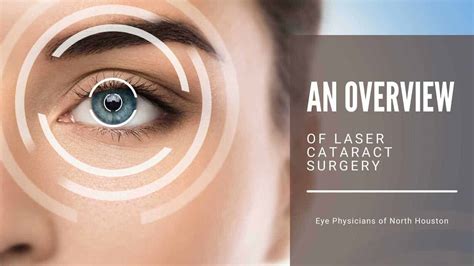 An Overview Of Laser Cataract Surgery Eye Physicians Of North Houston