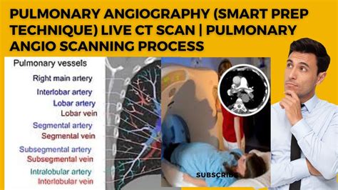 Pulmonary Angiography Smart Prep Technique Live Ct Scan Pulmonary