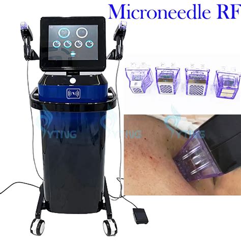 Morpheus8 Rf Microneedling System Radiofrequency Stretch Mark Removal