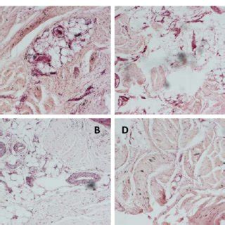 Haematoxylin and eosin staining of specimens [young (A) and old (B ...