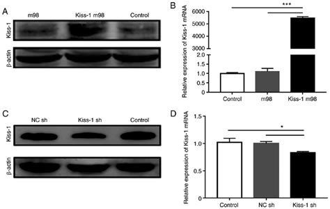 Expression Of Kiss 1 Mrna And Protein In Ags And Hgc 27 Cells After