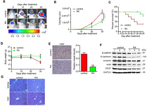 RA decreased glioma growth in an orthotopic xenograft mouse model ...