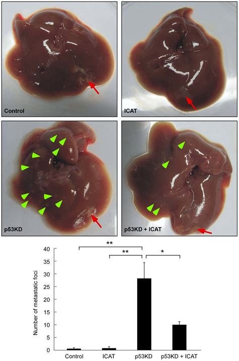 Intrahepatic Metastasis Of Liver Cancer Cells Is Enhanced By P53 Download Scientific Diagram