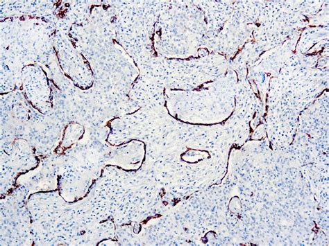 Cytokeratin Ae Ae Mob Diagnostic Biosystems Dbs