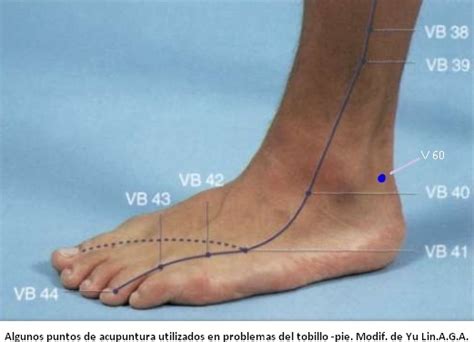 Esguince De Tobillo Y Acupuntura Dolor Crónico Acupuntura Y