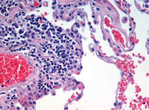 Perbedaan Antara Histologi Dan Sitologi Prodiffs