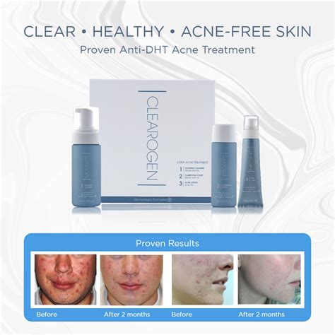 Clearogen Anti Dht Acne Treatment Hydropeptide Official Site