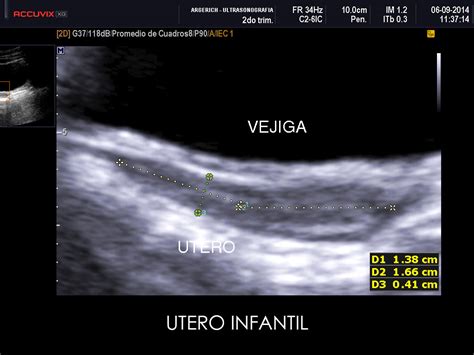 Ginecología