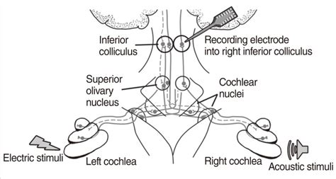 Schematic Basic Setting Of The Electric And Acoustic Stimuli And The