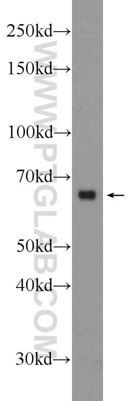 Cd44 Antibody 15675 1 Ap Proteintech 武汉三鹰生物技术有限公司