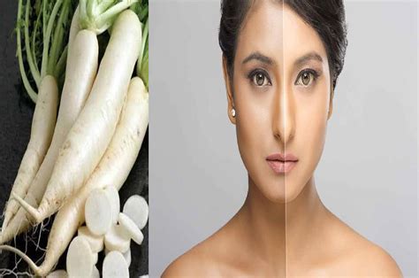 Skin Care Tips 1 मूली का नुस्खा बदल देगा चेहरे की रंगत मुंहासे होंगे गायब