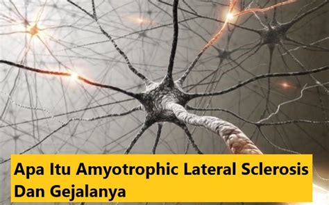 Apa Itu Amyotrophic Lateral Sclerosis Dan Gejalanya