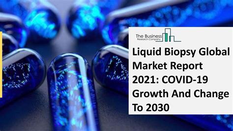 Liquid Biopsy Market 2021 Report Predictions By Global Industry Trends