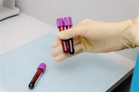 Hand Holding Test Tube With Blood Plasma Ready For Testing Stock Image