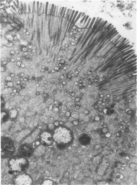 Low Power Electron Micrograph Of A Section Through Lim Cells That