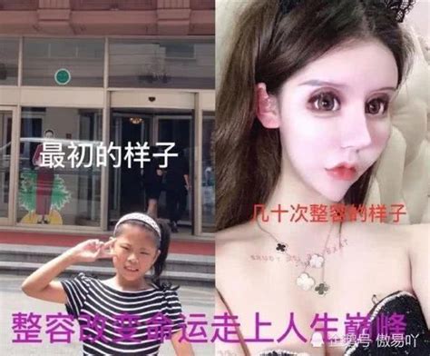 女孩13歲開始整容，整容60次花費百萬，母親大力支持，網友：真毀 每日頭條