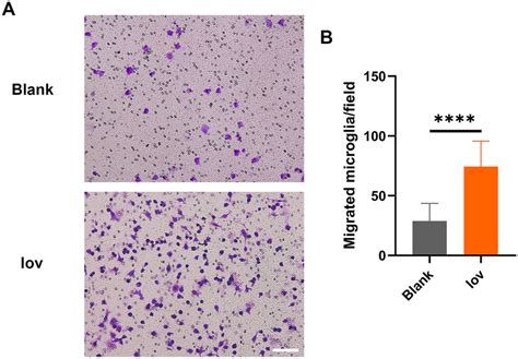 Microglia Migration In A Transwell Culture With Endothelial Cells A