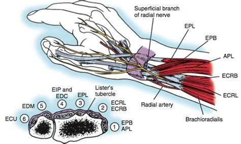 De Quervain S Tenosynovitis Handout Dr Thomas Trumble M D