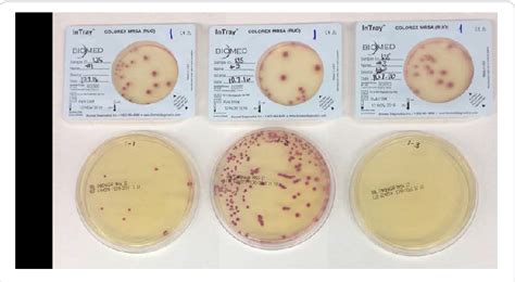 Figure 2 From Comparative Evaluation Of Biomed InTray Colorex MRSA