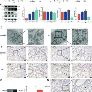 Piezo Mediates Ionizing Radiation Induced Pulmonary Endothelial Cell