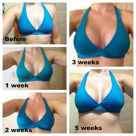 List 91 Pictures Breast Actives Before And After Photos Superb