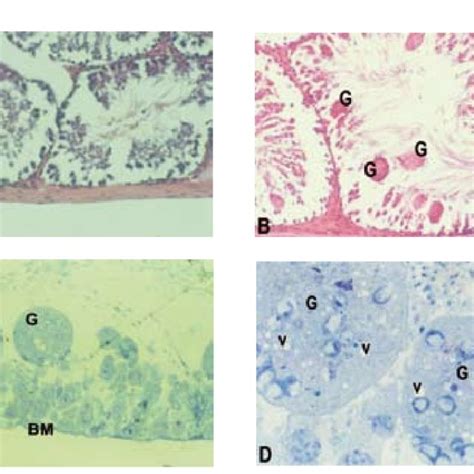 Transmission Electron Micrograph Of Rat Testis Section From Control Download Scientific Diagram