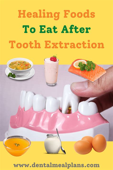 Healing Foods To Eat After Tooth Extraction And A Free Sample Meal