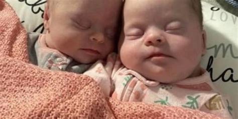 Florida Woman Gives Birth To Rare Set Of Identical Twins With Down