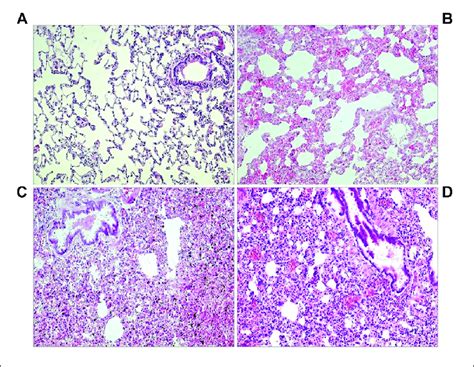 Lung Histology A Normoxic Control Normal Lung Tissue Without Download Scientific Diagram