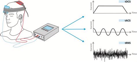 Frontiers Transcranial Electric Stimulation For Precision Medicine A