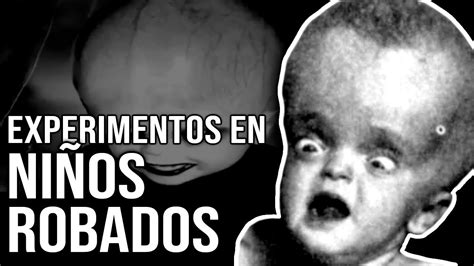 Los NIÑOS con DEFORMACIONES CABEZAS extremadamente grandes y CUERPOS