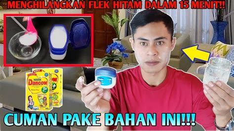 Cara Menghilangkan Flek Hitam Secara Alami Dalam Waktu Singkat Youtube