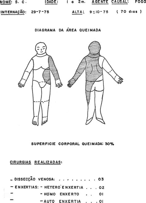 SciELO Brasil PROBLEMÁTICA CIRÚRGICA DA CRIANÇA QUEIMADA