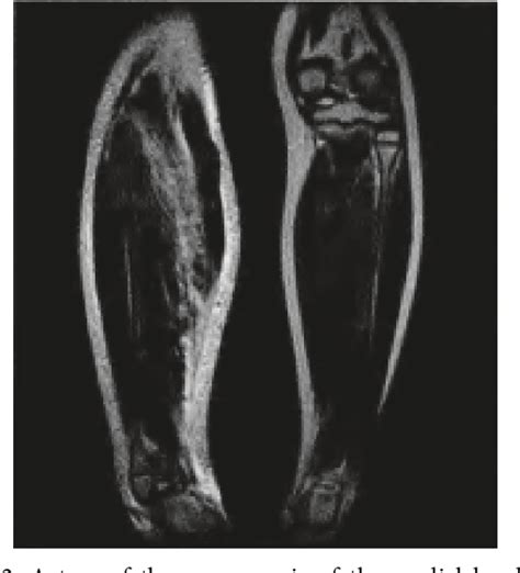 Figure 2 from The Application Value of MRI in the Training and Physical ...