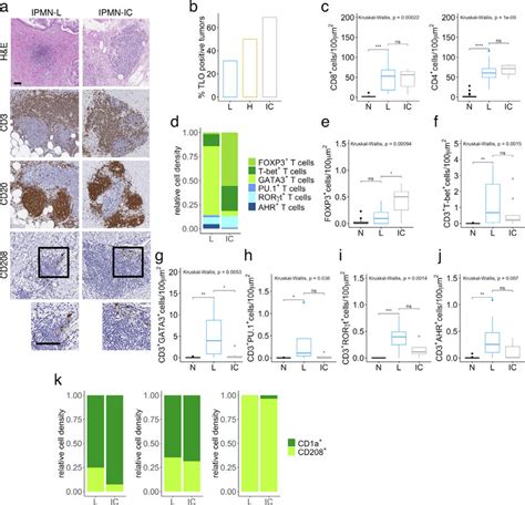 Tertiary Lymphoid Structures Tls Evolve From Low Grade Ipmn To