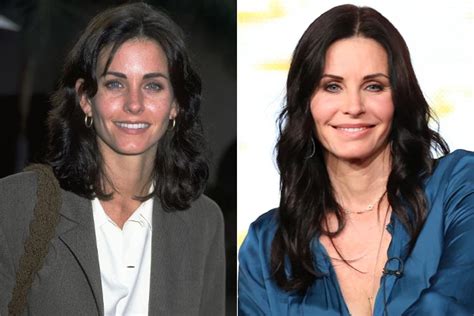 Courteney Cox Plastic Surgery Pictures