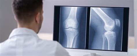 Why Does AFC Use Digital X-rays?