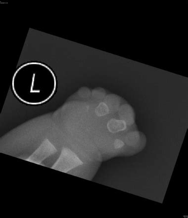 Radiology Quiz 51504 | Radiopaedia.org