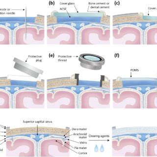 Examples Of Cranial And Spinal Window A A Sealed Cranial Windows