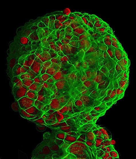 Three dimensional cell culture of breast cancer cells (MCF-7 cell line) | Nikon Small World