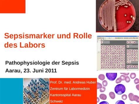 Ppt Sepsismarker Und Rolle Des Labors Pathophysiologie Der Sepsis