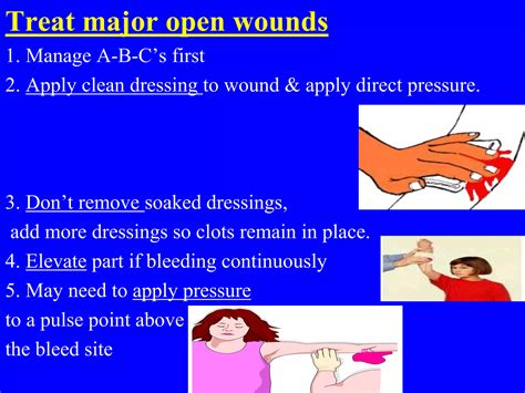 First Aid for Wounds | PPT