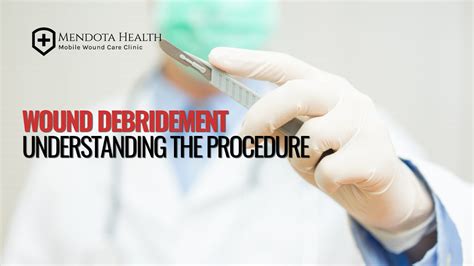 Wound Debridement Understanding The Procedure Mendota Health