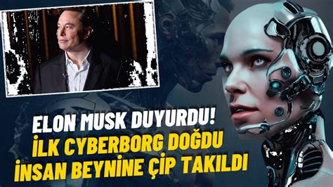 Elon Musk Duyurdu İlk Cyberborg Doğdu İnsan Beynine Çip Takıldı Ordu