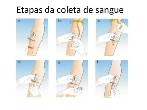 Aula De Instrumentação Biomédica Sobre Coleta E Amostras