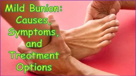 Bunion Causes - BUNION DR