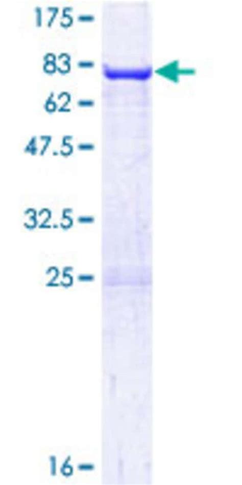 Abnova Human ARC Full Length ORF NP 056008 1 1 A A 396 A A